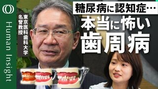 【健康寿命を延ばす歯磨き】東京医科歯科大学名誉教授・水口俊介／社会人も半年に１回は歯医者に／歯周病で糖尿病リスク上昇／フレイルによるプロセスを歯磨きで防止する【Human Insight】| TBS CROSS DIG with Bloomberg