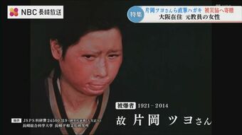 原爆で親族13人を亡くし 顔にケロイドが残った 故・片岡ツヨさんの直筆ハガキ　長崎被災協に寄贈　|　長崎のニュース | 天気 | NBC長崎放送