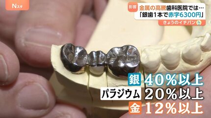 銀歯1本で赤字6300円」貴金属高騰で歯科医が悲鳴 金1グラム3万円の影で