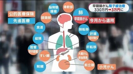 早期肺がん治療費330万円が3万円に 陽子線治療が今月から保険診療に