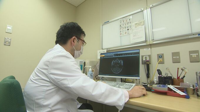 国内初の新薬を厚労省が承認…金沢大学もメカニズム解明に関わるアルツハイマー病治療薬「レカネマブ」年内にも流通へ　|　石川県のニュース｜MRO北陸放送
