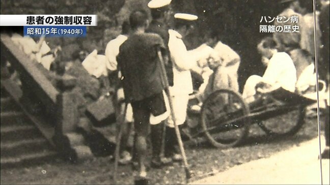 「傷が増えるとどんどん手足の指がなくなる」長島愛生園の山本典良園長が語る「ハンセン病はなぜ忌み嫌われたのか」(第1回/全3回)|TBS NEWS DIG