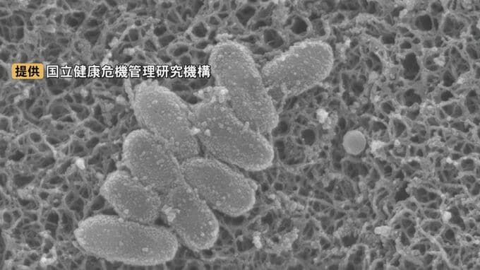 「百日せき」増加傾向…乳児の重症化に注意　対策は?「日中になかなか止まらない、夜間強くなるのが特徴の1つ」　|　BSSニュース | BSS山陰放送