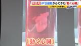 「病で苦しむ人を助けたい」"ドクドク鼓動"...細胞の数は「約３億個」iPS細胞でできた『動く心臓』　開幕まであと半年の「万博」最新技術を体感できるパビリオンが続々|TBS NEWS DIG