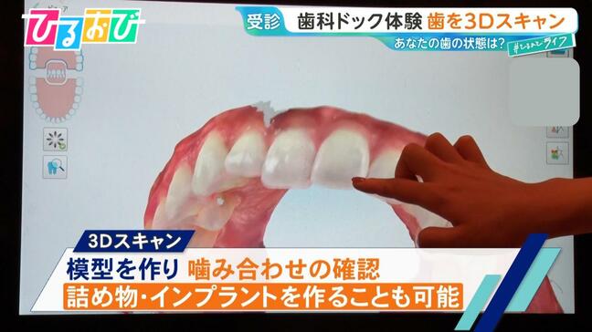 2人に1人が『歯周病』…予防に有効な「歯科ドック」って何をする？歯科医が教える簡単ケア術【ひるおび】|TBS NEWS DIG