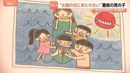 “太陽の光にあたれない”難病「色素性乾皮症」の男の子(5)「今を生きる大切さ」母が絵本に|TBS NEWS DIG
