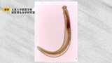皮下を幼虫がはう「顎口虫症」青森県で初確認 約130人に症状 多くはシラウオ加熱せず食べる|TBS NEWS DIG