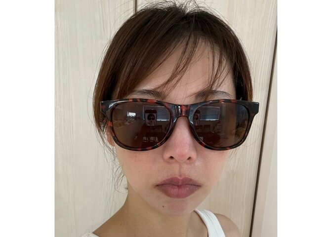 「最強レベルの結膜炎」　和泉杏さん　「激痛だし目が見えない！！」　状況明かす　「この世の終わりみたい」　　【ハナコ・菊田さん妻】|TBS NEWS DIG