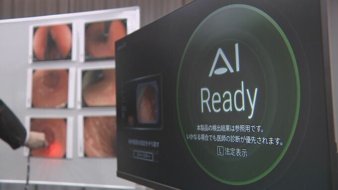 「3回ぐらい生きないと学習できないぐらい」胃がんのデータを学習している 「内視鏡AI」が販売開始　胃がん“ゼロ”時代を目指す