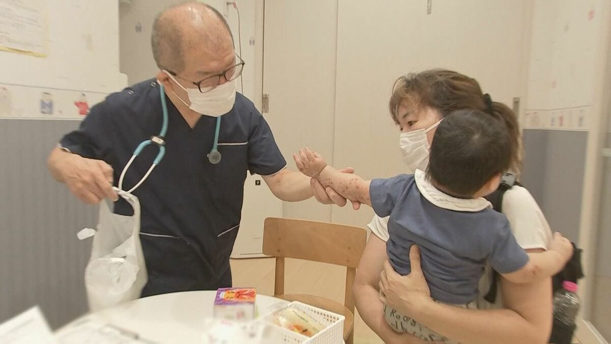 手足口病さらに感染拡大　ヘルパンギーナも警報水準超える　大分