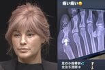 【 梅宮アンナ 】 「足の小指骨折 全治5週間」「痛い 痛い」 SNSで明かす|TBS NEWS DIG
