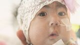 「一生懸命に生きている」染色体異常 18トリソミーの子どもたちの写真展|TBS NEWS DIG