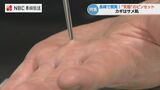 “究極のピンセット”開発のカギはサメ肌だった「薄皮だけを優しくしっかりつかむ」長崎 | 長崎のニュース | 天気 | NBC長崎放送