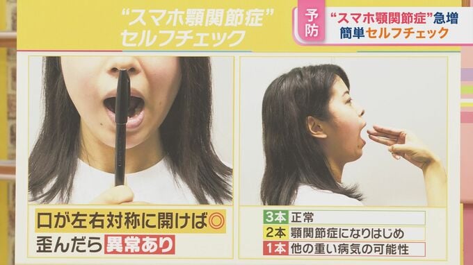 重症化すると手術も… “スマホ顎関節症”に注意  あなたは大丈夫？簡単セルフチェック【ひるおび】|TBS NEWS DIG