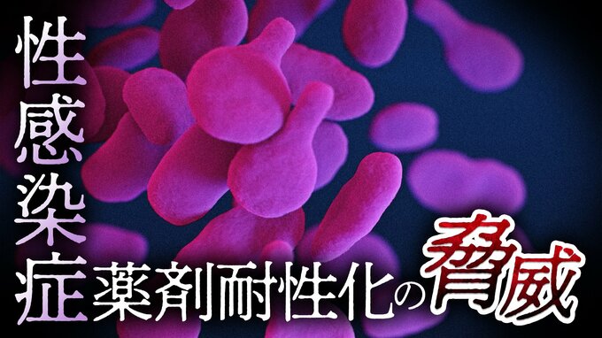 性感染症“淋病”の特効薬「ペニシリン」はほぼ効かない？迫る薬剤耐性化の脅威…難航する新薬開発の裏で専門医が強調する予防対策「セーファーセックス」|TBS NEWS DIG