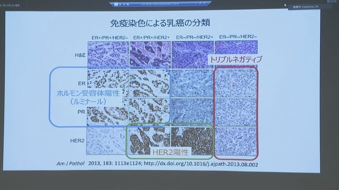“乳がん”再発治療に光明!既存の「心不全薬」に効果が 原因細胞を金大など研究グループが解明 | 石川県のニュース|MRO北陸放送