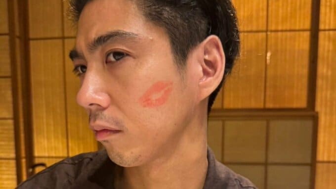 【 榮倉奈々 】「世界で一番私にやさしいひと」の頬にはキスマーク　夫・賀来賢人の誕生日の直前に|TBS NEWS DIG