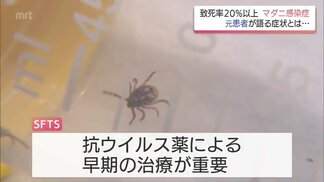 「命、取られたな」致死率2割超マダニ感染症「SFTS」 元患者が語る恐怖と重症化防ぐポイントは・・・ | MRTニュース | MRT宮崎放送