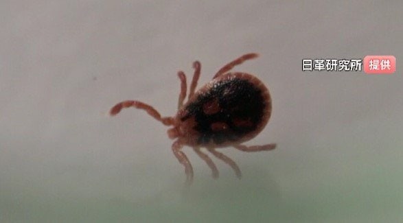 「意識がもうろう…現在も入院中」マダニが媒介する感染症＝SFTS（重症熱性血小板減少症候群）感染者、長野県内で初確認…関西地方に住む60代男性…頭痛や発熱症状、県外から長野市内訪れた後、医療機関受診、陽性確認　|　SBC NEWS | 長野のニュース | SBC信越放送