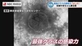 最強クラスの感染力「はしか」妊婦や赤ちゃんがいる家庭は要注意 ワクチン接種回数や感染歴不明の場合《抗体検査》を 長崎 | 長崎のニュース | 天気 | NBC長崎放送