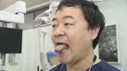あごが痛い“顎関節症” マスク生活でコロナ禍前より増えている 予防法は「なにぬべ体操」|TBS NEWS DIG