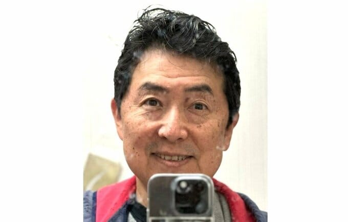 【 笠井信輔 】 「少し右目が開き始めきました」 帯状疱疹の退院から3週間 「片目で生活すると言うのは、本当に大変で、疲れます」|TBS NEWS DIG