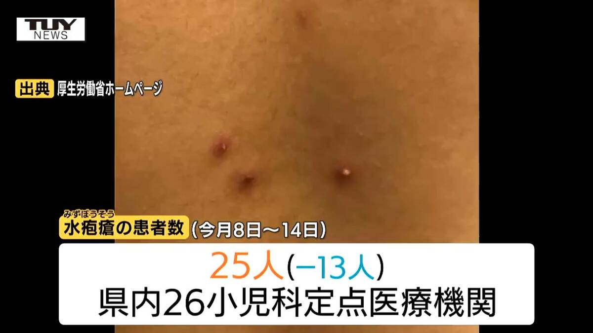 空気感染などでも広がる「水ぼうそう」 村山と最上で警報レベル 県内