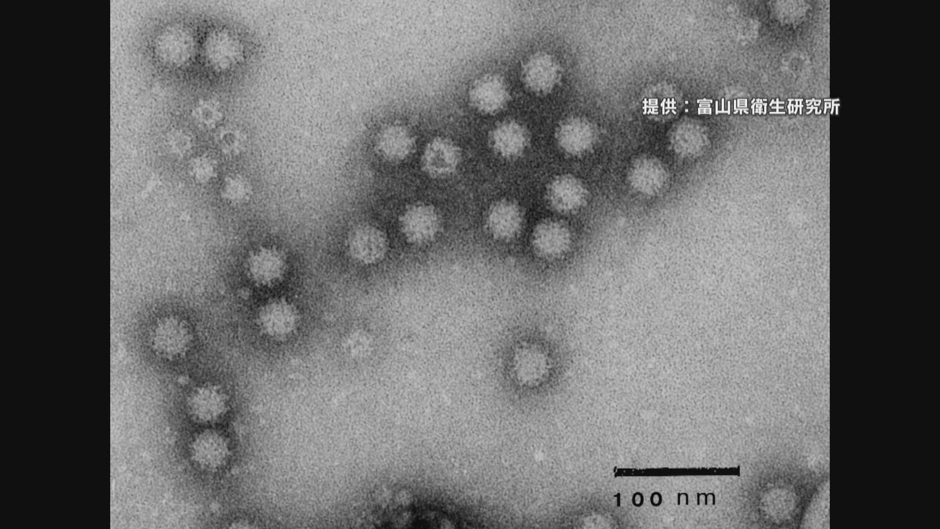 ノロウイルスによる食中毒 約1000人に弁当を提供 29人が下痢や嘔吐 富山県高岡市 | TBS NEWS DIG