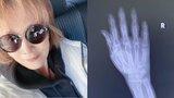 小柳ルミ子さん『「おっ‼️ 良いですねー‼️」ですよー‼️』右手骨折から順調に回復中|TBS NEWS DIG