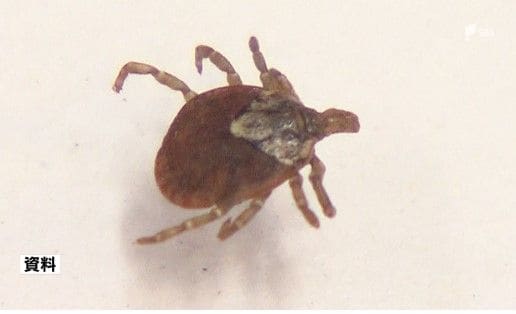 マダニが媒介する重症熱性血小板減少症候群に感染 60代男性集中治療室で治療中 2025年県内初確認＝静岡　|　静岡のニュース | SBSNEWS | 静岡放送