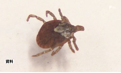 マダニに注意を！最悪の場合死に至る「日本紅斑熱」静岡県内で新たに3人の感染を確認|TBS NEWS DIG