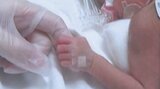 「リトルベビー」小さく生まれることに悩む母親 我が子の成長を願う仲間の輪広がる | 大分のニュース|OBS NEWS|大分放送