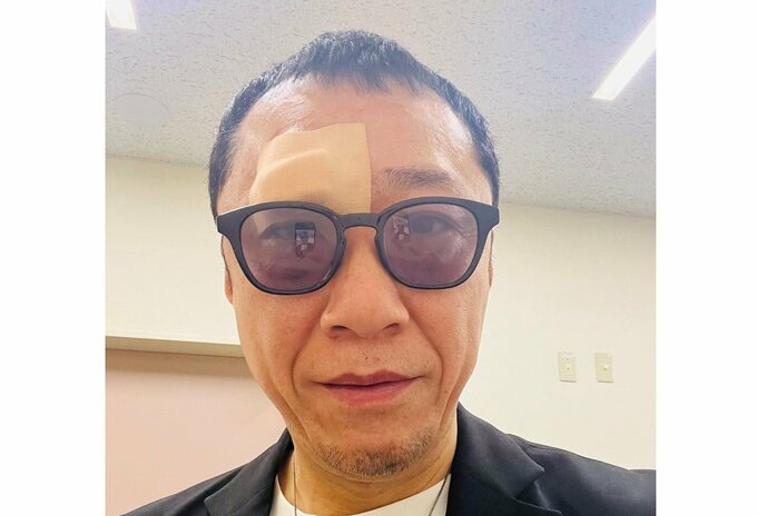 【幹てつや】　ガラス扉に「顔面をぶつけ」　救急車で搬送　「眉の辺りを数針縫うケガ」　【元・ボキャブラ天国・キャブラー】|TBS NEWS DIG