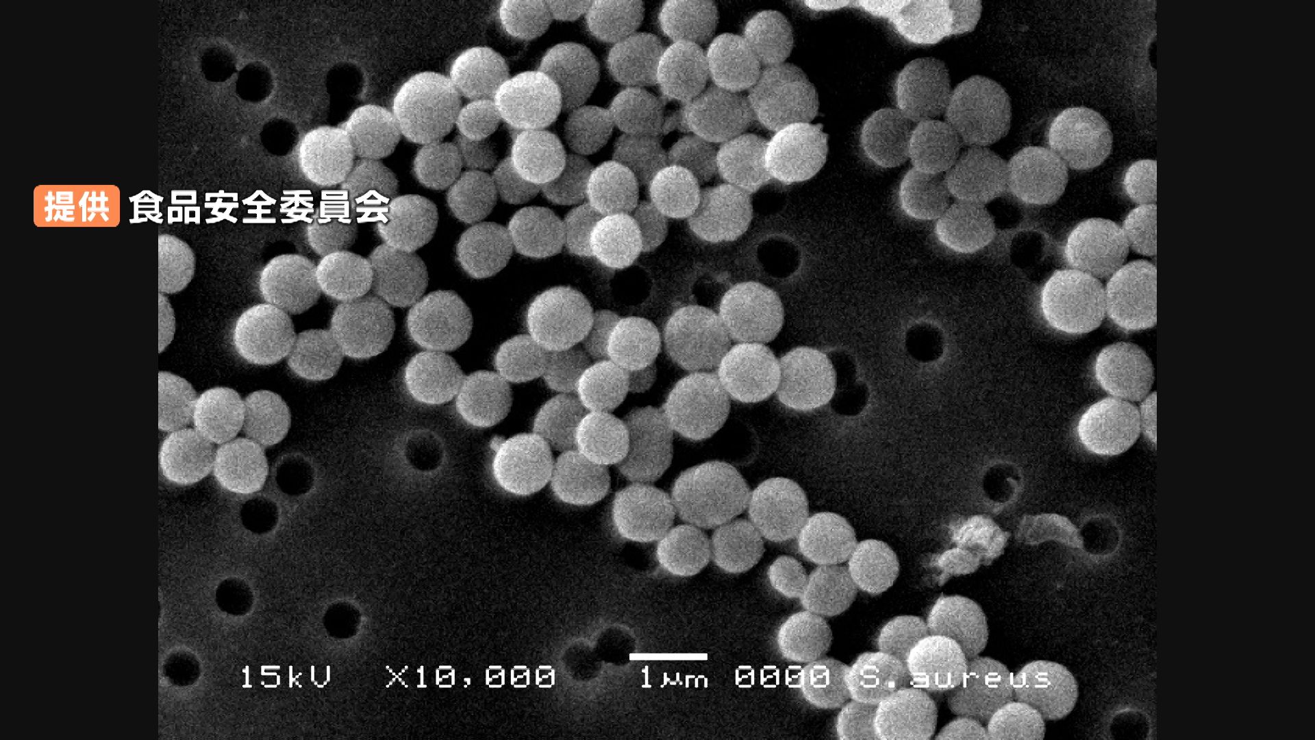 ブドウ球菌性状 _ ブドウ球菌 嫌気性 – GWCA