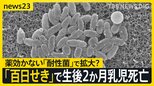 「百日せき」3週連続で患者数過去最多 生後2か月の乳児が死亡 薬が効かない「耐性菌」で感染拡大か【news23】|TBS NEWS DIG