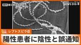 レプトスピラ症の陽性患者に陰性と誤通知 「検査工程でヒューマンエラー」衛生研が検体取り違え | 沖縄のニュース|RBC 琉球放送