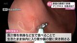 家庭での調理で発症が多いアニサキス食中毒 釣ったり、もらったりした魚に要注意 | MRTニュース | MRT宮崎放送