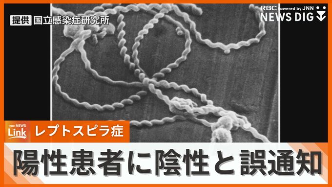 レプトスピラ症の陽性患者に陰性と誤通知　「検査工程でヒューマンエラー」衛生研が検体取り違え　|　沖縄のニュース｜RBC 琉球放送