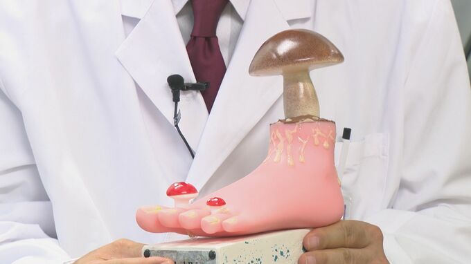 キノコがデザインされたユニークなトロフィー