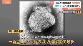 「はしか」感染者数 前年同期比4倍以上に　今年累計139人 2020年以降最多|TBS NEWS DIG