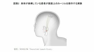 脳の機能を強化？「BMI」の衝撃～あなたが見ているものは電気信号の集積にすぎない～| TBS CROSS DIG with Bloomberg