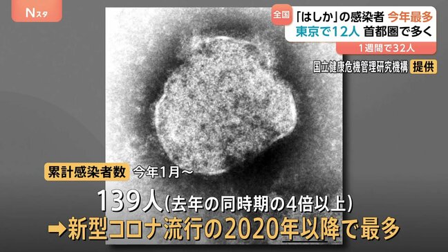 「はしか」感染者数 前年同期比4倍以上に　今年累計139人 2020年以降最多|TBS NEWS DIG