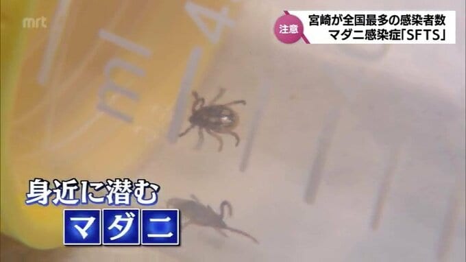 感染者100人に達し死者26人　ペットなど動物を介して感染も　急増するマダニ感染症「SFTS」　|　MRTニュース ｜ ＭＲＴ宮崎放送