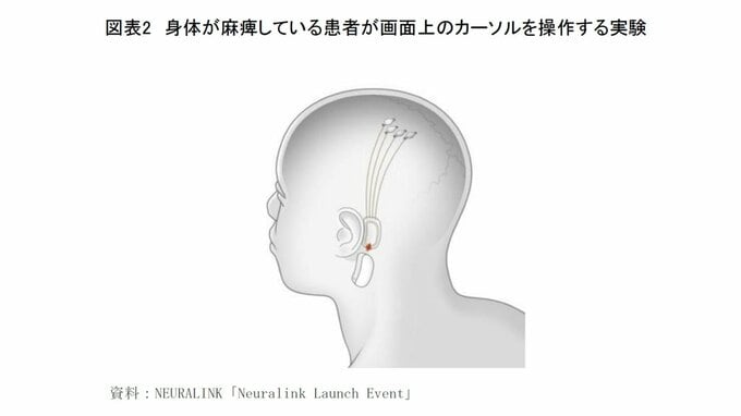 脳の機能を強化？「BMI」の衝撃～あなたが見ているものは電気信号の集積にすぎない～