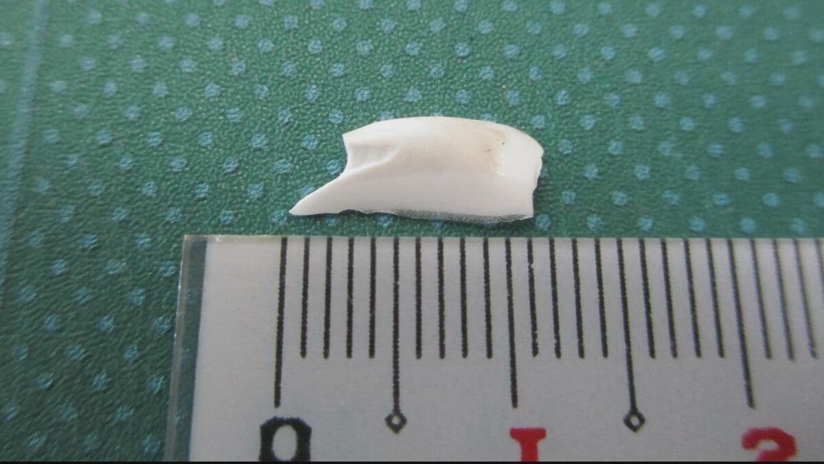 給食のサラダに1.2センチの陶器破片…生徒が違和感で吐き出す　けがはなし　皿の底が欠けたか　大分