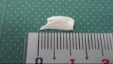 給食のサラダに1.2センチの陶器破片…生徒が違和感で吐き出す　けがはなし　皿の底が欠けたか　大分|TBS NEWS DIG