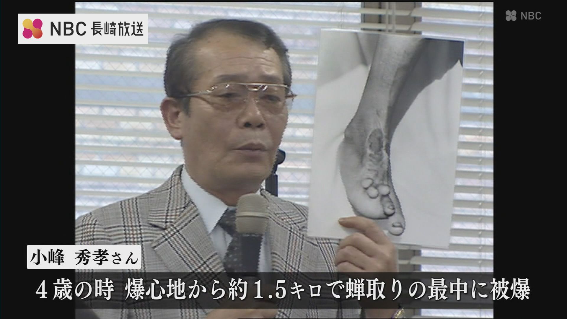 長崎原爆青年乙女の会会長 被爆者小峰秀孝さん死去（ＮＢＣ長崎放送）｜ｄメニューニュース（NTTドコモ）