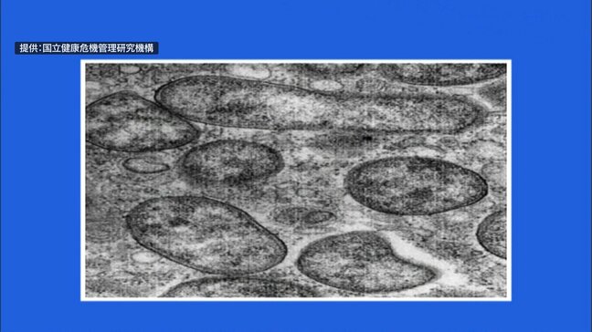 「つつが虫病」に90代女性が感染　ダニの一種「ツツガムシ」に刺されて感染　上北保健所管内|TBS NEWS DIG