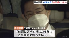 【速報】岸田総理の出邸　午後に後ろ倒し　週末に鼻づまりの手術「まだ長い時間、喋りづらい」| TBS CROSS DIG with Bloomberg