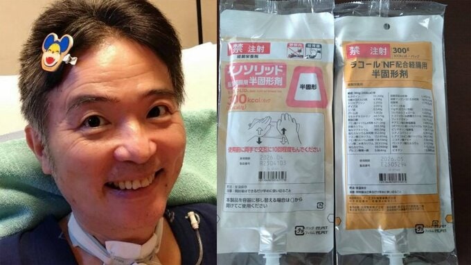 【ニャンちゅう】　声優・津久井教生さん　「胃瘻から入れているのに結構味の違いが分かります」投与している経腸栄養剤の切り替えを報告　【ＡＬＳ闘病】|TBS NEWS DIG